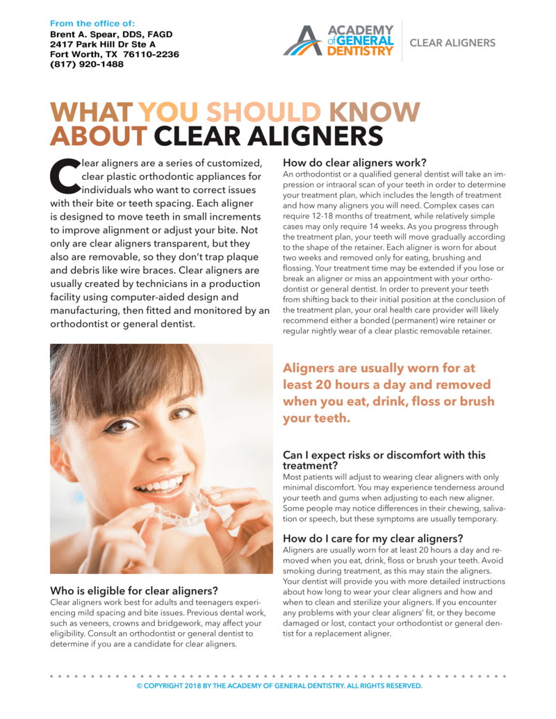 What You Should Know About Clear Aligners