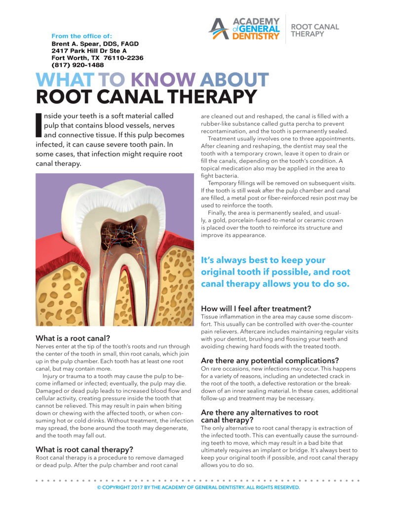 What To Know About Root Canal Therapy