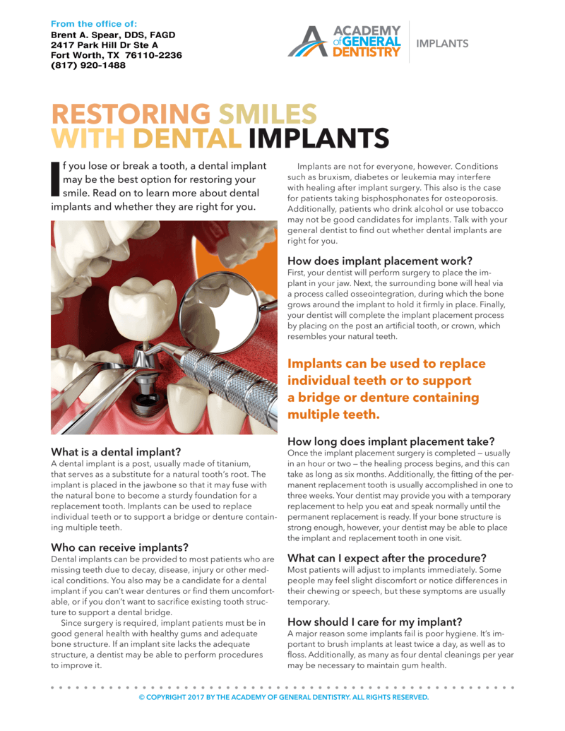 Restoring Smiles With Dental Implants